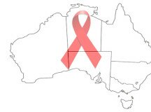 L’Australia e la “fine” dell’epidemia di aids. Come stanno davvero le cose?